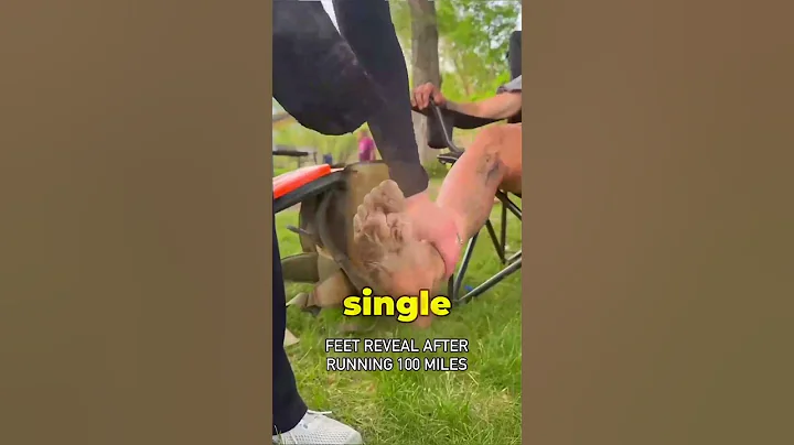 Feet After a 100 Mile Marathon (‪@BrockCovington‬) #shortsfeed #trendtalks #fitness