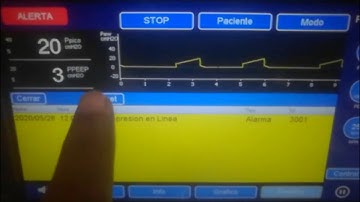 GUI de Respirador con EmWin STemWin STM32 STM32F767 GUI HMI