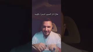 علاج اثار الحبوب السمراء بالوجة