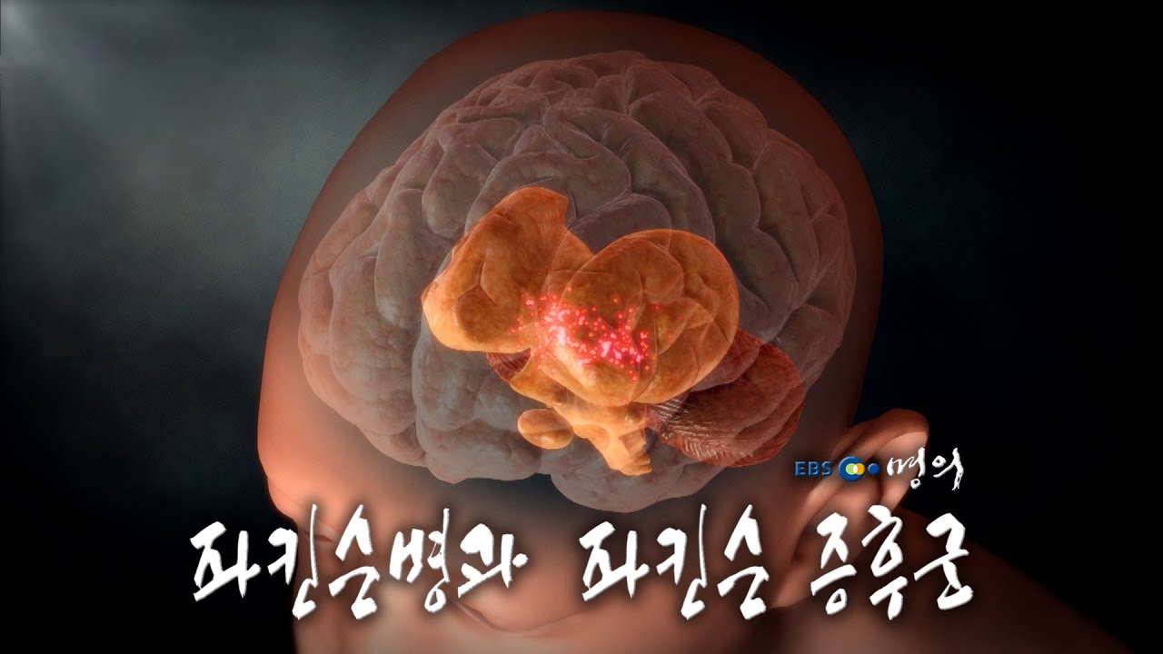 [명의 의학백과📖] 파킨슨병과 파킨슨증후군 - YouTube