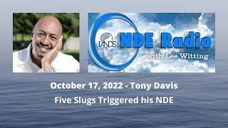 Tony Davis: Five Slugs Triggered his NDE