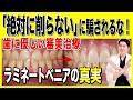 【ラミネートベニア】「絶対に削りません」という歯医者に騙されるな！審美治療の最前線と正しいクリニックの選び方