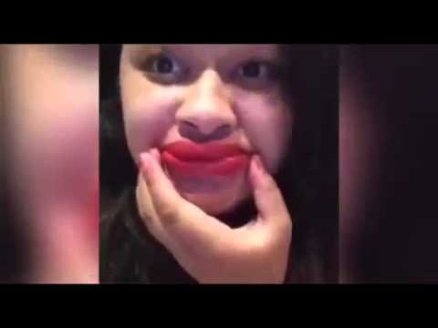 Βίντεο: Kylie, σταμάτα! Τα χείλη και τα ζυγωματικά της Jenner μεγαλώνουν. Σχολιασμός ειδικών
