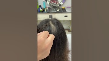 Thumbnail of Perfect Coverage for Bald Spots! | Invisible Cover-up Hair Patches