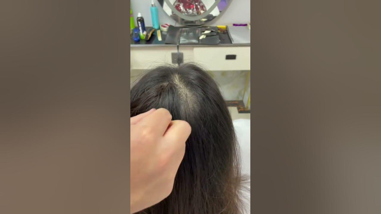 Perfect Coverage for Bald Spots! | Invisible Cover-up Hair Patches