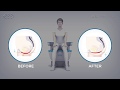 BTL EMSELLA® - Mechanism of action