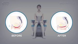 BTL EMSELLA® - Mechanism of action