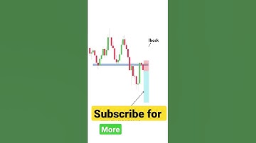 Pushkar Raj Thakur said which one is best #riskmanagement #shorts #pushkarrajthakur #sharemarket