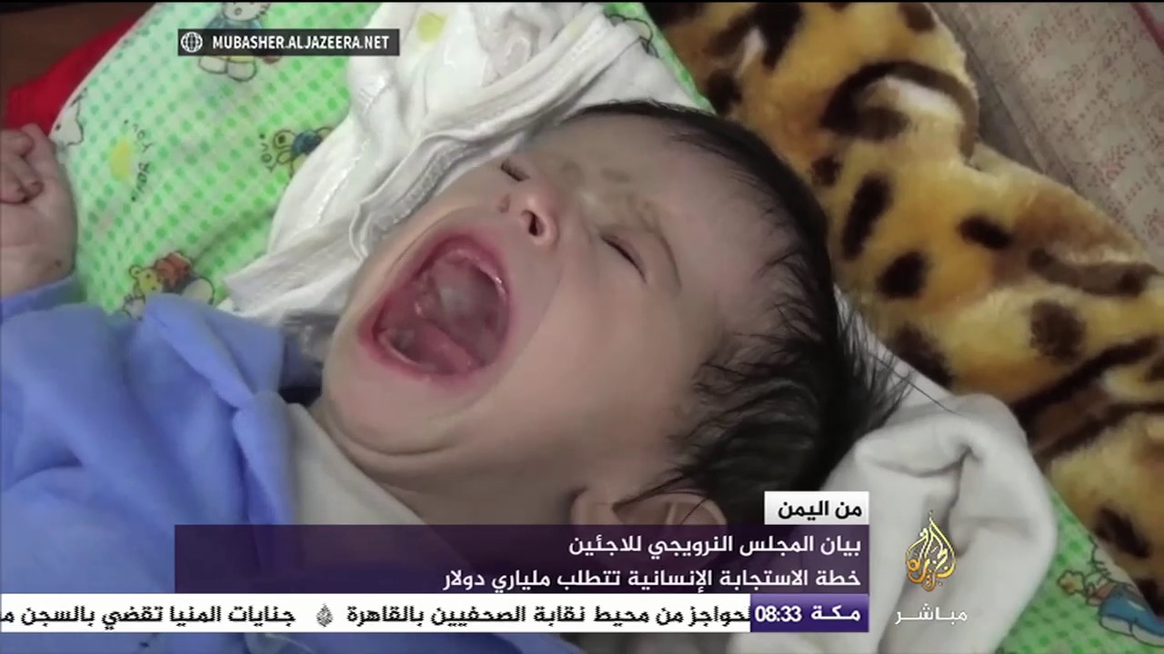 يستعينون بالعكاكيز والأطراف الصناعية للدفاع عن أرضهم .. مصابون من اليمن