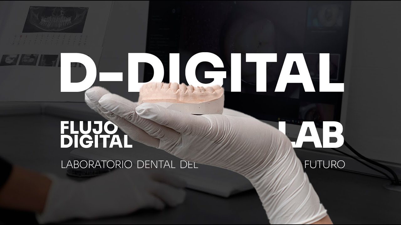 D-DIGITAL LAB BARCELONA | Laboratorio dental especializado en flujo ...