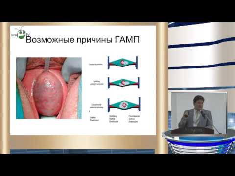 Еркович А А - Рациональная терапия гиперактивного мочевого пузыря
