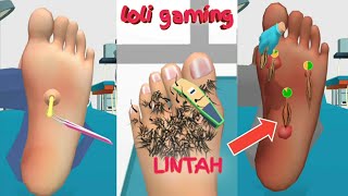 Download lagu TELAPAK KAKI DIOBATI DENGAN LINTAH⚠️‼‼⁉️😱 | FOOT CLINIC | LOLI GAMING