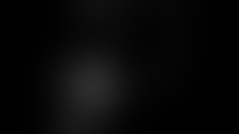 Lap Stomach GIST: Dhaval Mangukiya