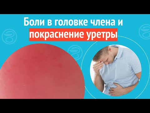 😓 Боли в головке члена и покраснение уретры. Клинический случай №1196