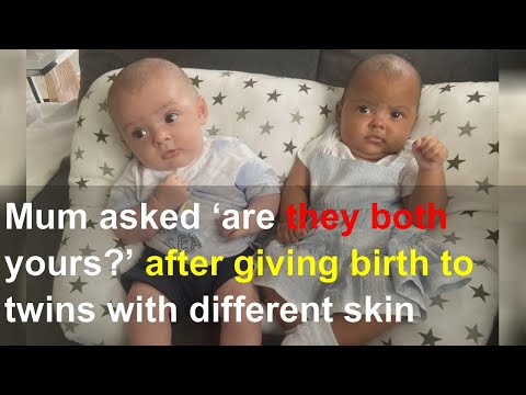 Mum asked ‘are they both yours?’ after giving birth to twins with different skin shades
