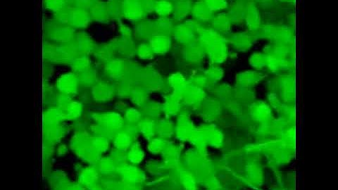 3T3 Fibroblast Cells in Jammed Microgels