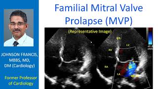 Familial Mitral Valve Prolapse (MVP)