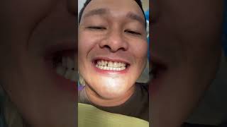 Tooth Restoration At Gaoc Dental Clinic