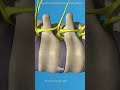 Spinal decompression therapy #drone #theflash #space #automobile