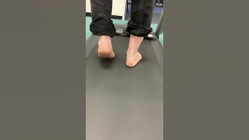 Gait Analysis/ Achilles tendinitis