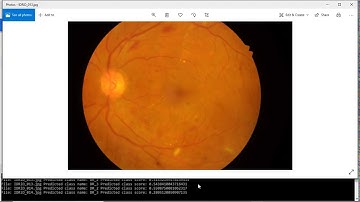BUDSTA Healthcare Launch - Diabetic Retinopathy Detection using AI - Machine Learning