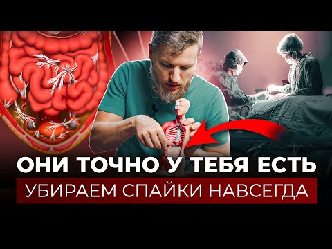 СПАЙКИ – как убрать навсегда?