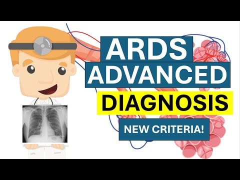 Острый респираторный дистресс-синдром (ОРДС) – Диагностика | Клиническая медицина