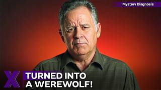 He Suddenly Aged Overnight And Turned Into A Werewolf! | Mystery Diagnosis | Season 2 Episode 2