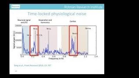 Review of Quality Control Considerations for Resting-state fMRI: Dr. Jean Chen