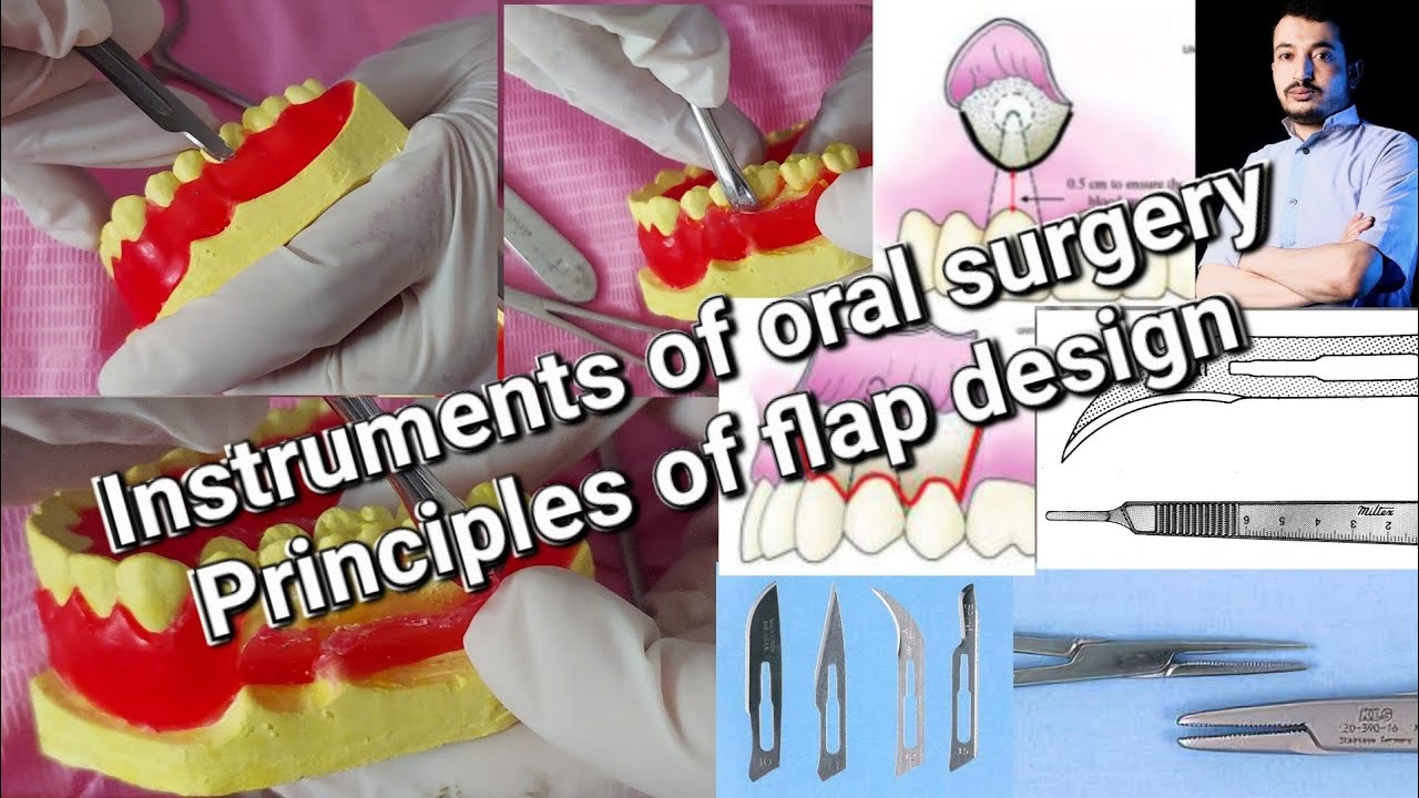 Instruments of Oral Surgery and Principles of Flap Designs