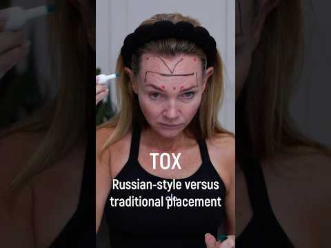 Face Tox: Russian-style versus traditional placement
