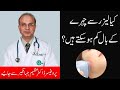Laser Hair Removal Technology Is It Effective For Face Best Treatment In Lahore At Cosmetique 