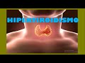 HIPERTIROIDISMO FISIOPATOLOGÍA