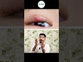 Are You Suffering From Stye Dr Hamid Muhiyadheen Stye Eyes Stress Healthtips 