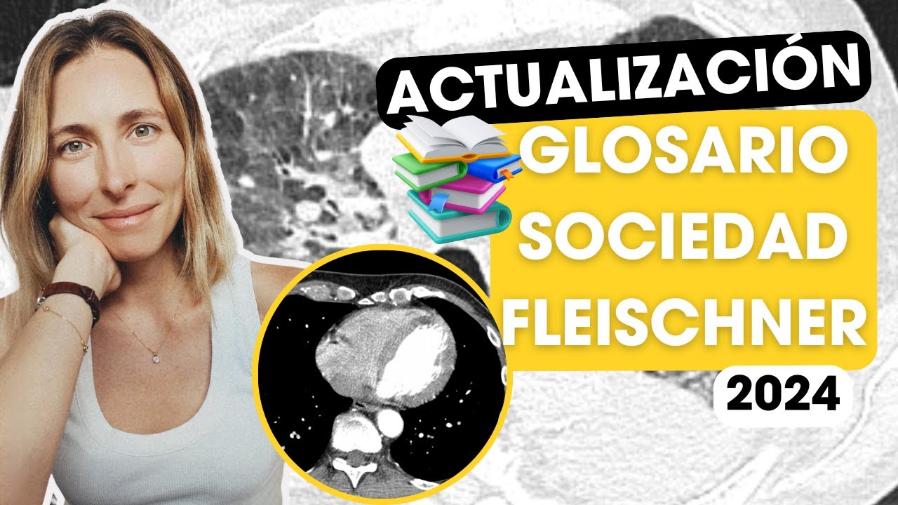 No sabes qué palabras usar? 🤔Actualización del glosario de la guía de Fleschner (Parte 1) ✅
