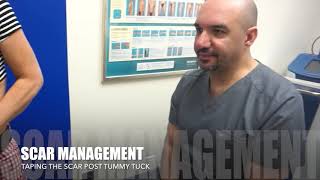 POST TUMMY TUCK | SCAR MANAGEMENT