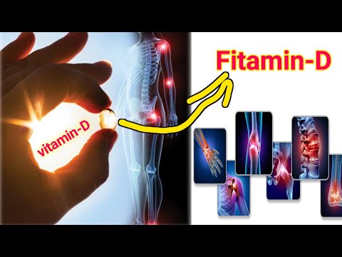 Fitamin D Gaada Marka Uu Yaryahay Calaamadaha Lagu Garto Iyo Sida Loo Daaweeyo Uurka