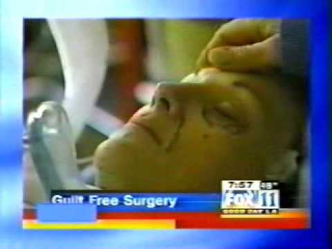 Beverly Hills Plastic Surgery News - No Guilt Facelift - Face Lift