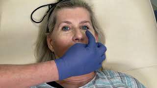 LIVE Laser Skin Resurfacing vs Lower Eyelid Surgery TODAy at Noon! Join us with Liz Bonis.(Edited)