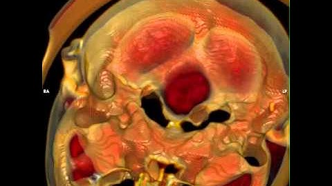 Computed Tomography Imaging 8 - William Edward Hahn