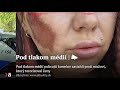 Pod tlakom médií policajti konečne zasiahli proti mužovi, ktorý terorizoval ženy | Aktuality #n-l