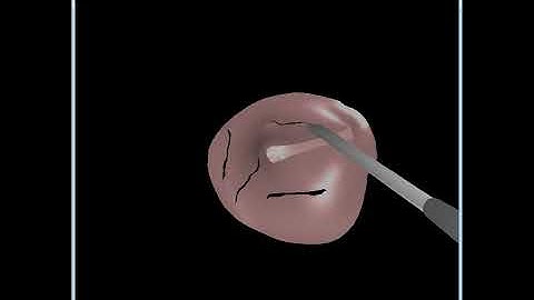 Virtual reality incisions