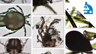 Algae Corner: "What Is It?" - Mites With Bite Profile