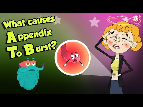 Why Appendix Burst? | APPENDIX | Dr Binocs Show | Peekaboo Kidz
