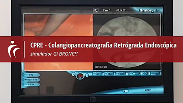 Quais os riscos de uma CPRE?
