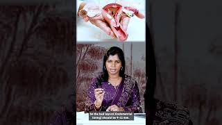 #miscarriages | Miscarriage அதிகமாக பெண்களுக்கு ஏற்ப காரணம் | Dr. B.Yoga Vidhya #women #pregnancy