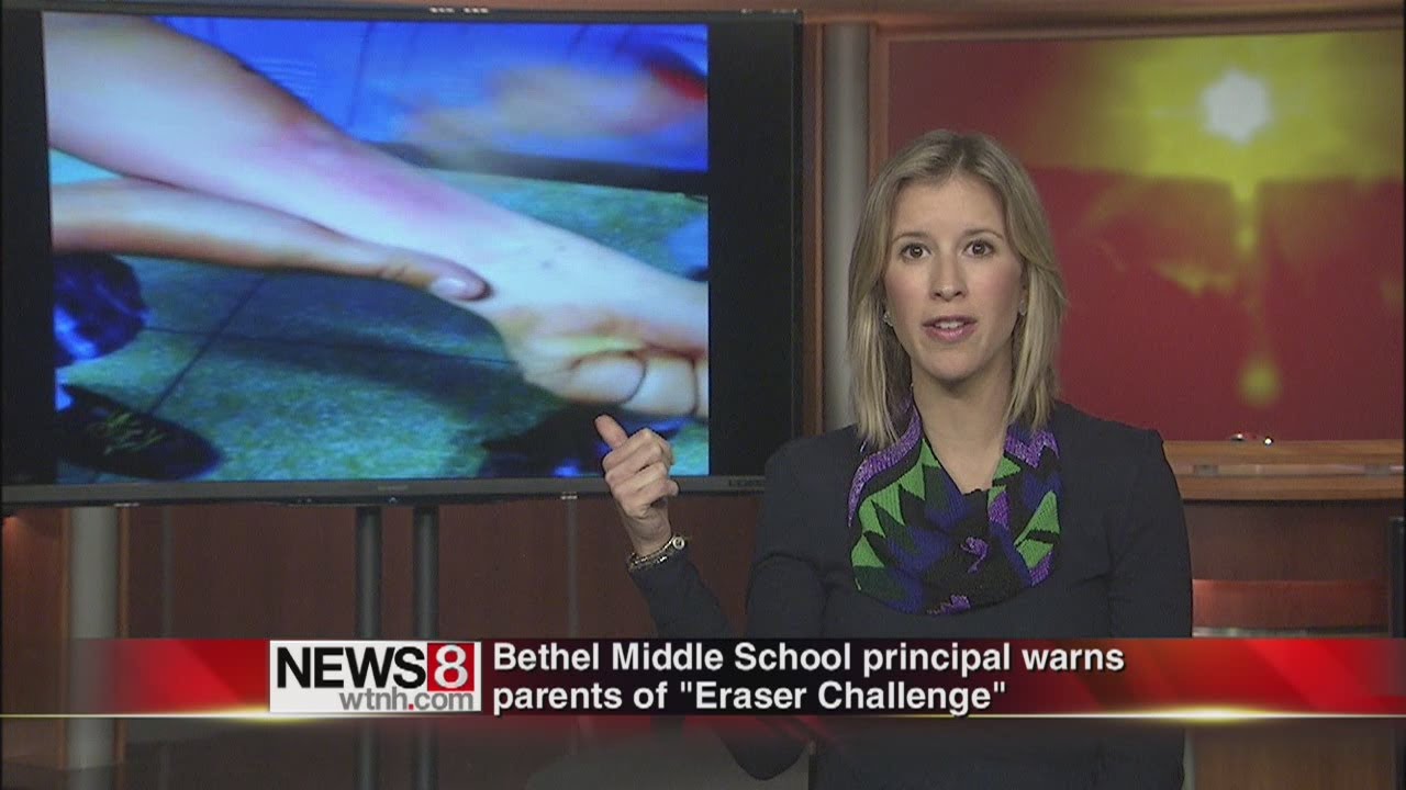 Parents alerted about 'Eraser Challenge' YouTube