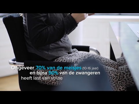 Video: Paarse Striae: Oorzaken, Risicofactoren En Behandeling