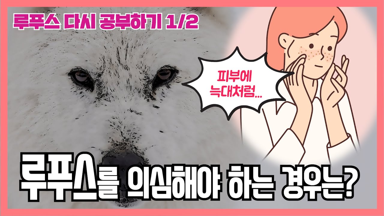 [루푸스 다시 공부하기] 루푸스를 의심해야 하는 경우는? (1/2)