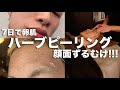【美容】画面が剥離‼︎ハーブピーリングでニキビ跡さようなら❤︎